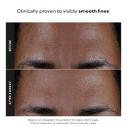 Paula's Choice SKIN PERFECTING 2% BHA Liquid Leave-On Exfoliant | Gentle Salicylic Acid Leave-On Facial Exfoliator for Blackheads, Enlarged Pores, Wrinkles & Fine Lines