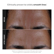 Paula's Choice SKIN PERFECTING 2% BHA Liquid Leave-On Exfoliant | Gentle Salicylic Acid Leave-On Facial Exfoliator for Blackheads, Enlarged Pores, Wrinkles & Fine Lines